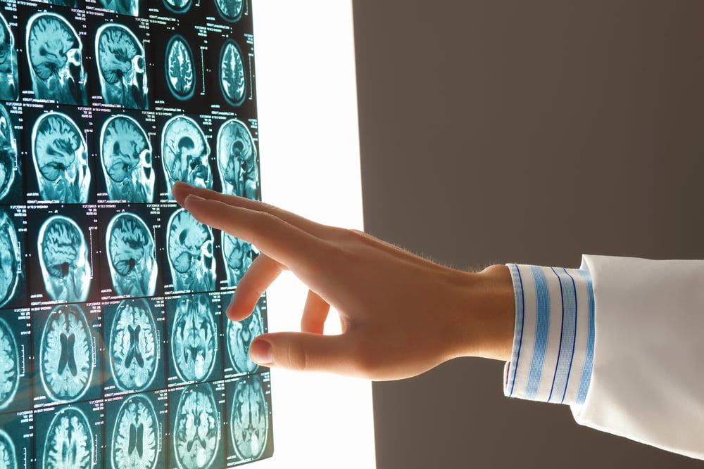 close-up image of doctor pointing hand at x-ray images, healthcare equipment leasing